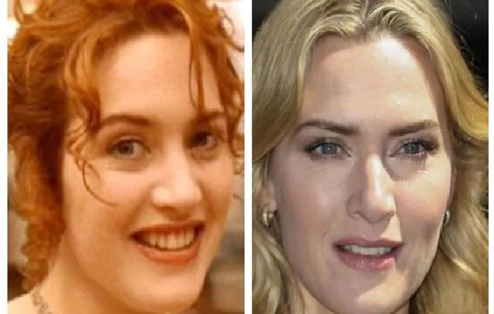 Criticized for her body, Kate Winslet reveals the remarks that have marked her for life